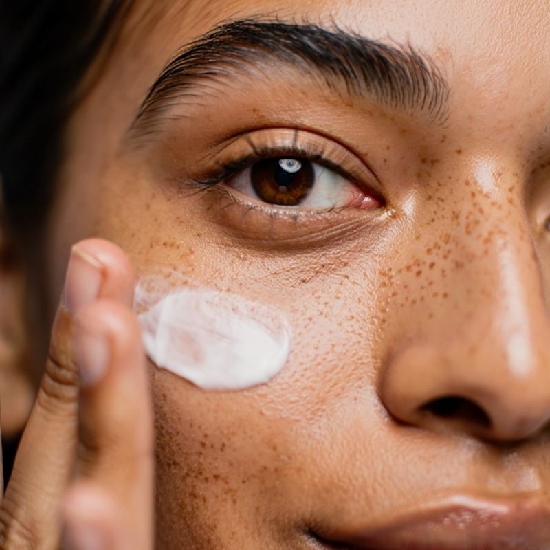 Body Acne Treatment: Effective Solutions for Clear and Healthy Skin